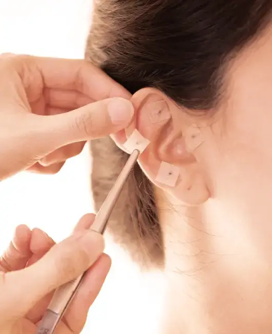 Sukra Hospital Acupuncture Therapy